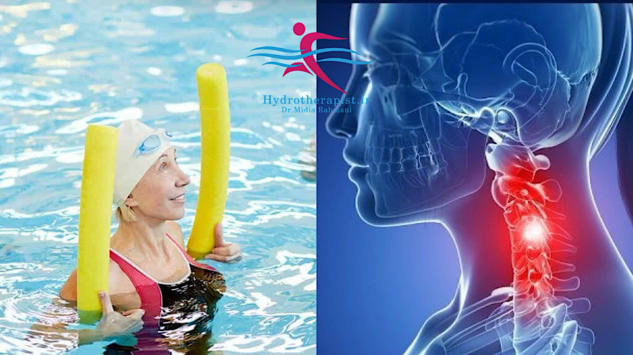 تأثیر آب‌درمانی بر درمان دیسک گردن: یک مقاله پژوهشی جامع